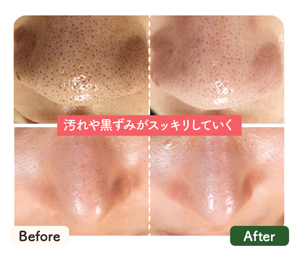 ベルジュールひたちなかの毛穴洗浄